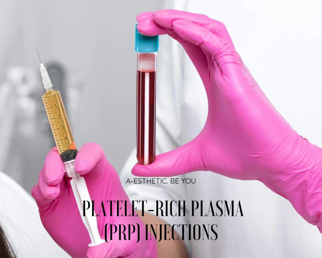 Platelet-Rich Plasma