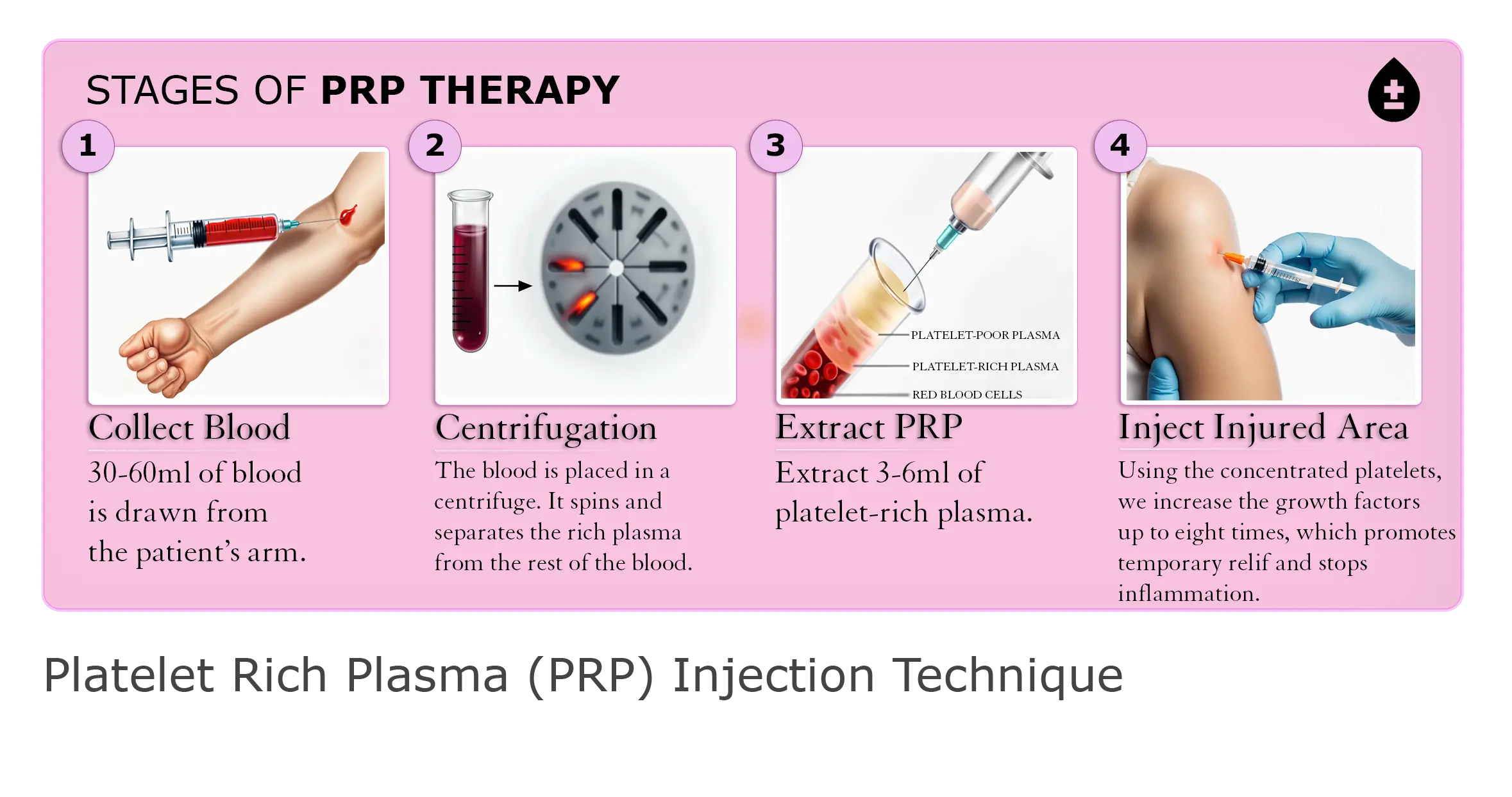 Revitalize Your Joints and Muscles With Platelet Rich Plasma Injections
